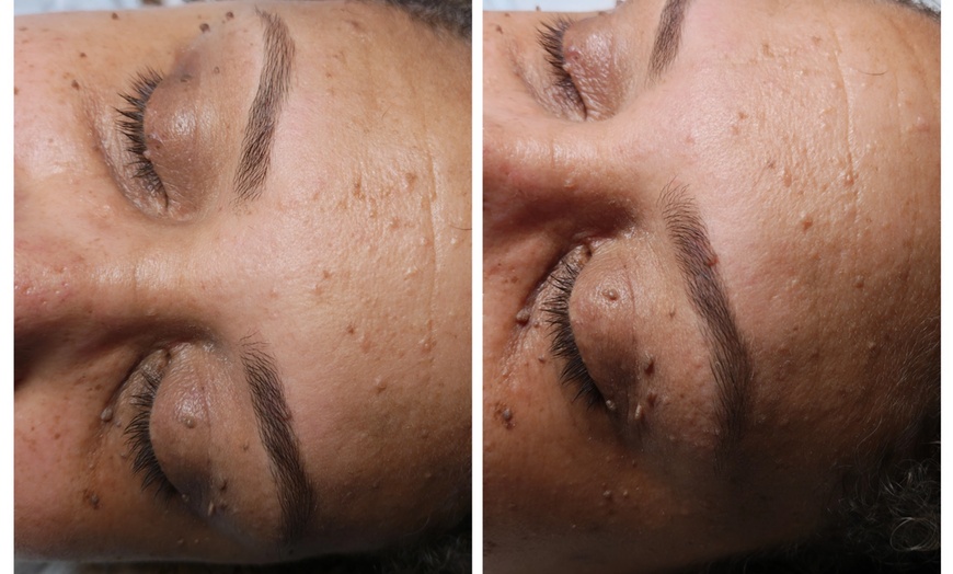 Image 8: One Majestic Lash Lift Session W/ or W/o Brow Wax, Lamination Session
