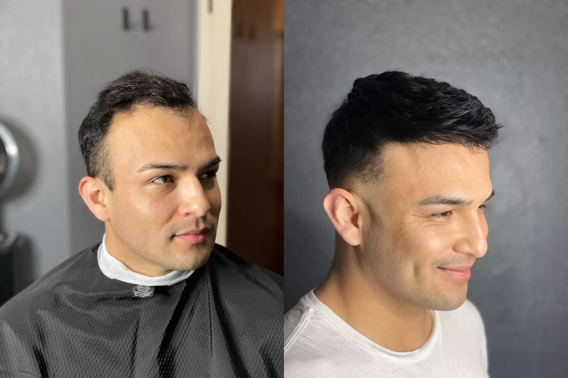 Up to 45% Off on Hair Restoration - Non-Surgical at Strandly hair