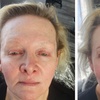 Image 2: Perfect Brows with One Microblading Session with or without Touch-Up 