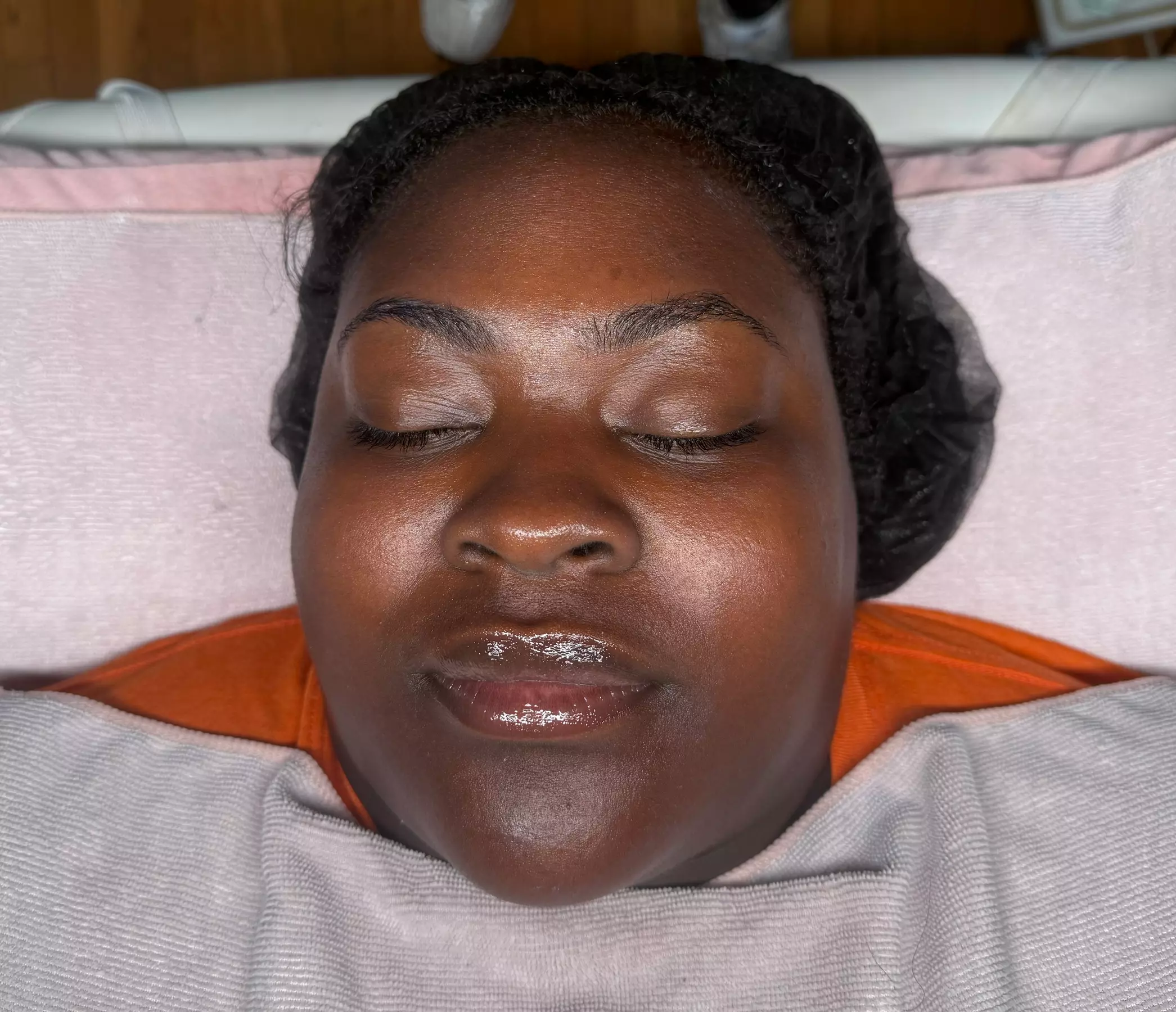 Up to 32% Off on Microdermabrasion at Skin Haven