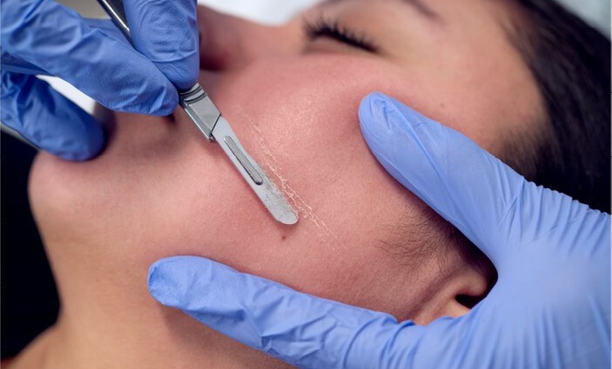 Image 1: Enjoy One Session of Express Dermaplaning, LED Light Therapy Options