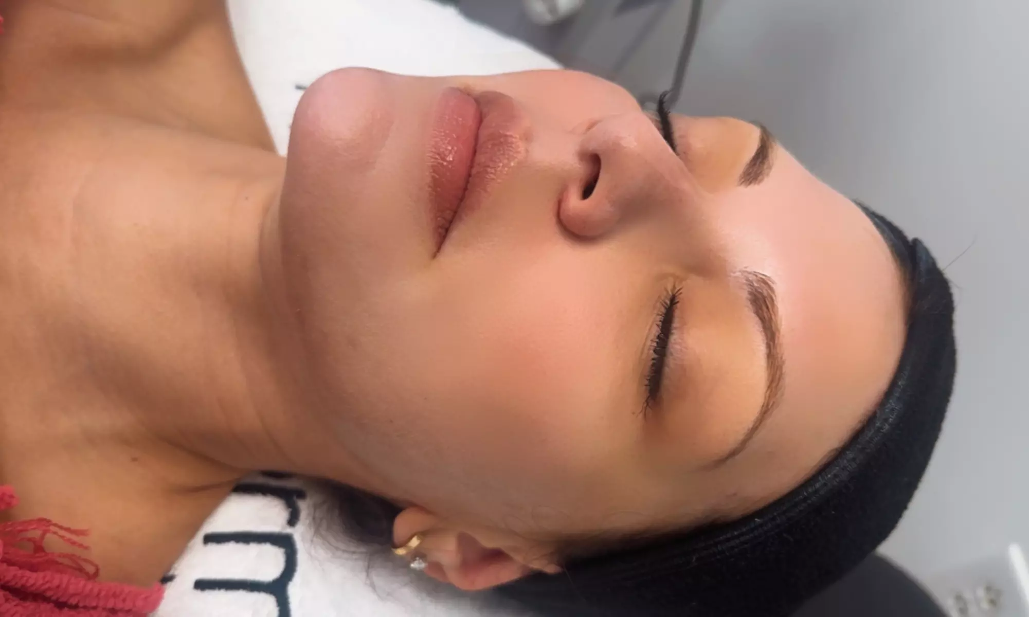 Up to 50% Off on Microdermabrasion at Soriaskincare