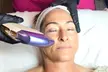 Embrace Youthfullness with HIFU/Ultherapy for Upper Face, Double Chin, or Neck, Offering (Up to 42%Off) - Second Medium