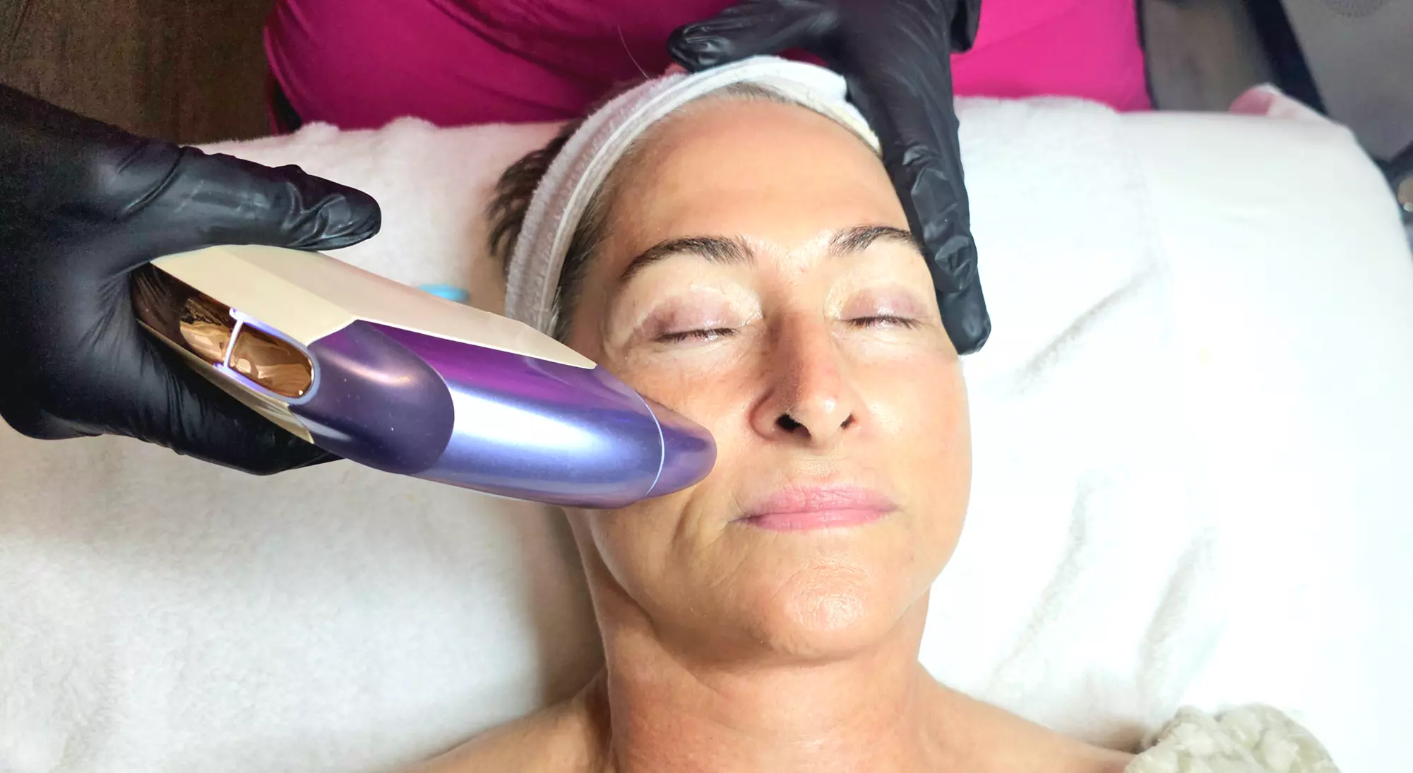 Lift & Tighten: HIFU/Ultherapy for Upper Face, Double Chin, or Neck