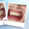 Image 2: Up to 76% Off on Teeth Whitening at Aesthetics Care Med Spa