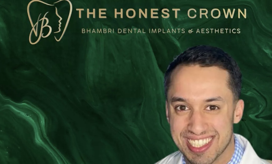 Image 3: Dental Implants