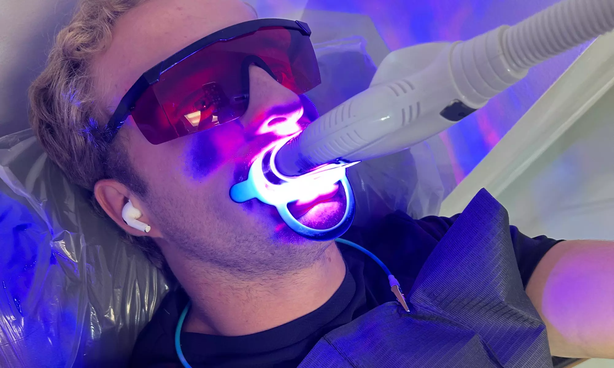 Sun Kissed Glo And Beauty Bar's Teeth Whitening: Three Tailored Options for a Brighter Smile up to 39% Off