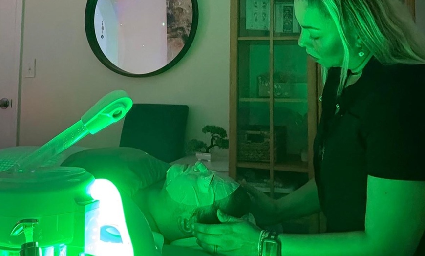 Image 6: Professional Facials & Microdermabrasion for Youthful, Radiant Skin