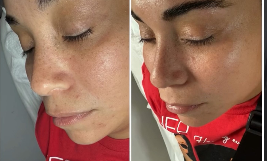 Image 2: Brow Tinting and Lamination Combo for Fuller Brows