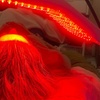 Image 2: Rejuvenate Your Skin with Acne Facial & LED Therapy