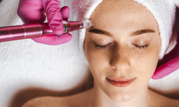 Experience Renova Spa's microneedling sessions with Collagen treatment, offering up to 40% off
