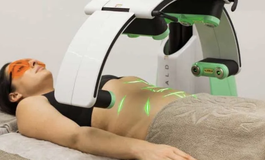 Image 1: Up to 55% Off on Lipo - Non-Invasive Laser-iLipo at Benefit Aesthetics