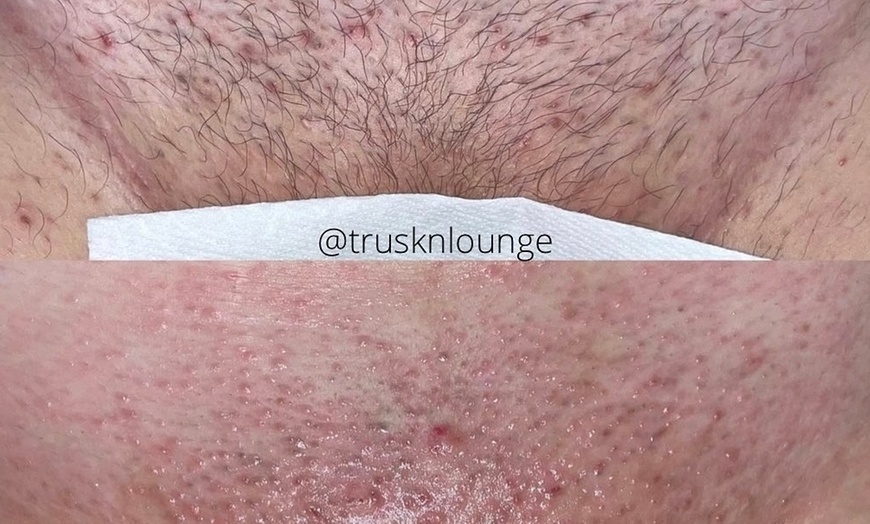 Image 7: Smooth Skin with One or Three Brazilian, or Eyebrow Waxing Sessions