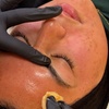 Image 2: Up to 10% Off VI Chemical Peel at Skin Society Medical Spa