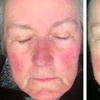 Image 9: Achieve Radiance with 6, 10, or 20 Dermalux MD Triwave LED Therapy 