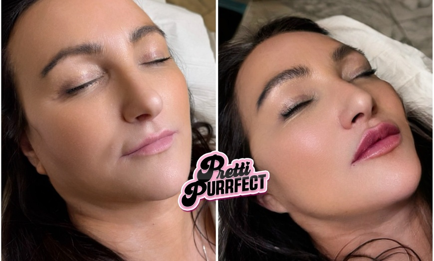 Image 6: Up to 68% Off on Injection - Dermal Filler at Pretti Purrfect