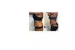 Up to 63% Off on Fat Reduction - Non-Branded at Your Sculpt Studio - Second Medium