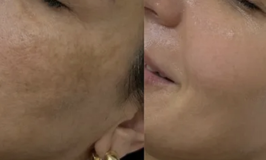 Image 2: Unifiez votre teint avec un soin anti-taches ciblé 5G Removal