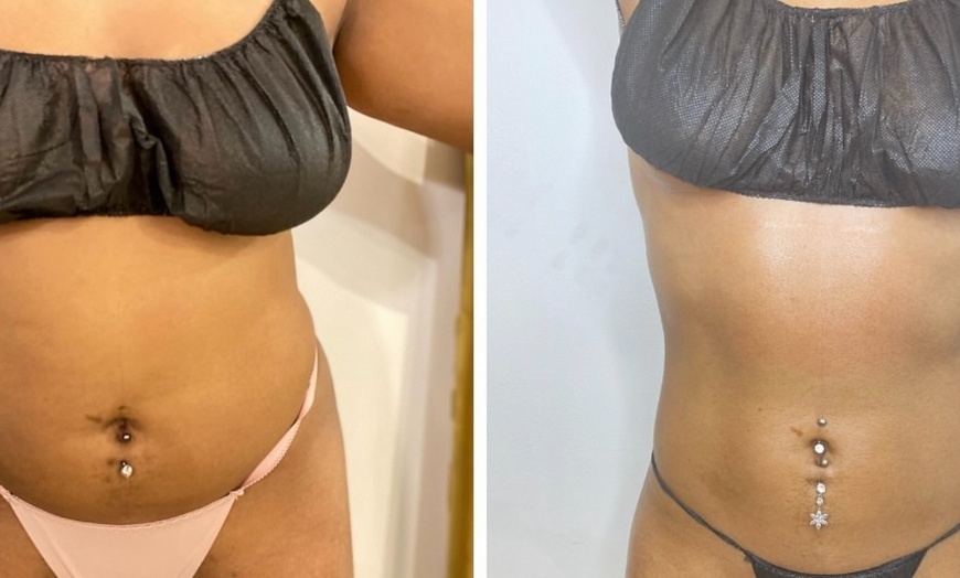 Image 2: One Hour Full Body Lymphatic Rub at Sound Sculpting Solutions