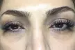 Get Eyelash Extensions in Texarkana + Non-Invasive Butt Lift ( Up to 50%) - Second Medium