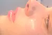 Up to 43% Off on Lip Enhancement at AB Botox Queen - Second Medium
