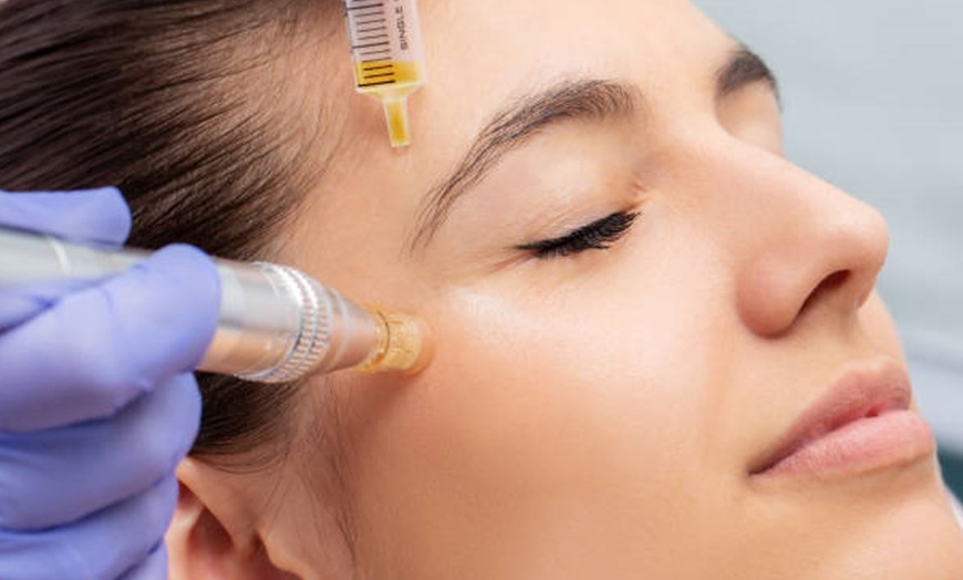 Image 3: Dr Murad-Technoceuticals Peel/Skin Booster-Microneedling & Dermaplane