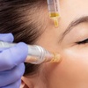 Image 3: Dr Murad-Technoceuticals Peel/Skin Booster-Microneedling & Dermaplane