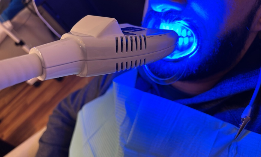Image 1: Teeth Whitening Full Service Treatment 60-minute and More