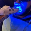 Image 1: Teeth Whitening Full Service Treatment 60-minute and More