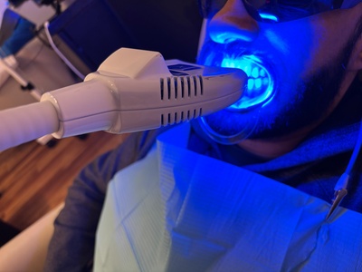 Boost your smile within 30 minutes (recommended within 6 months after first treatment with us) - Glowology Studio