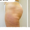 Image 6: Three, Six or Nine Sessions of VelaShape