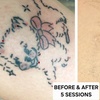 Image 1: Bellagena Offers Three Laser Tattoo Removal Sessions for Small, X-Small, or XX-Small Areas (Up to 56% Off)