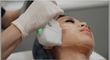 One HIFU Treatment for Under Chin (Double Chin) - SlimmThicc Aesthetics Spa