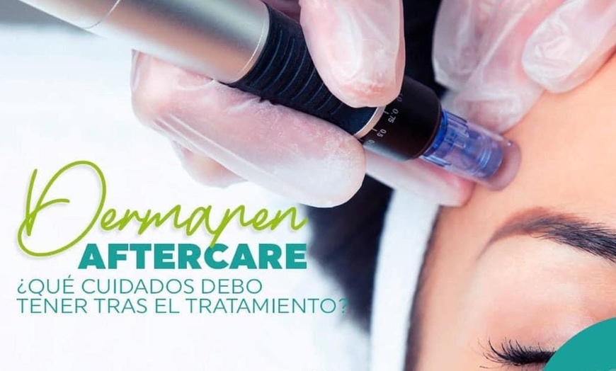 Image 5: Experience up to 50% off rejuvenating microdermabrasion with oxygen therapy at Le Club Euro Cosmetic in Miami