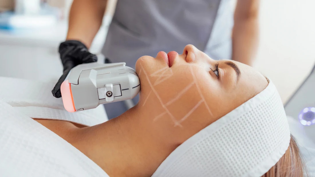 Up to 55% Off on HIFU Ultrasound Lift at Time for You