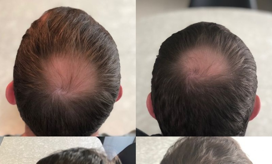 Image 9: Up to 58% Off on Salon - Hair Straightening Treatment at UK Aesthetics Lounge