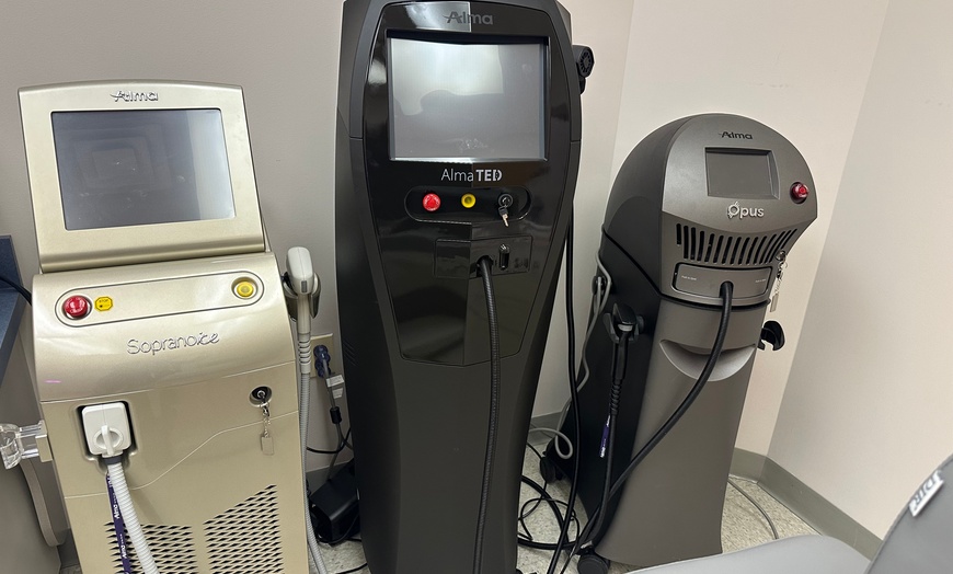 Image 4: Alma Opus Plasma Resurfacing for Wrinkles, Dark Spots & Skin Laxity