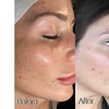 Image 2: Up to 55% Off on Spa / Salon Beauty Treatments at Oh my glow llc