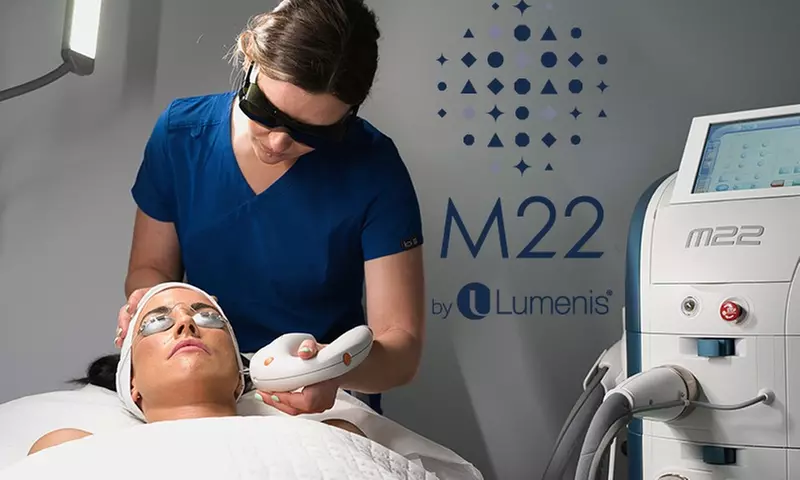 Fade Pigmentation & Redness with IPL Therapy at -Up to 56% Off