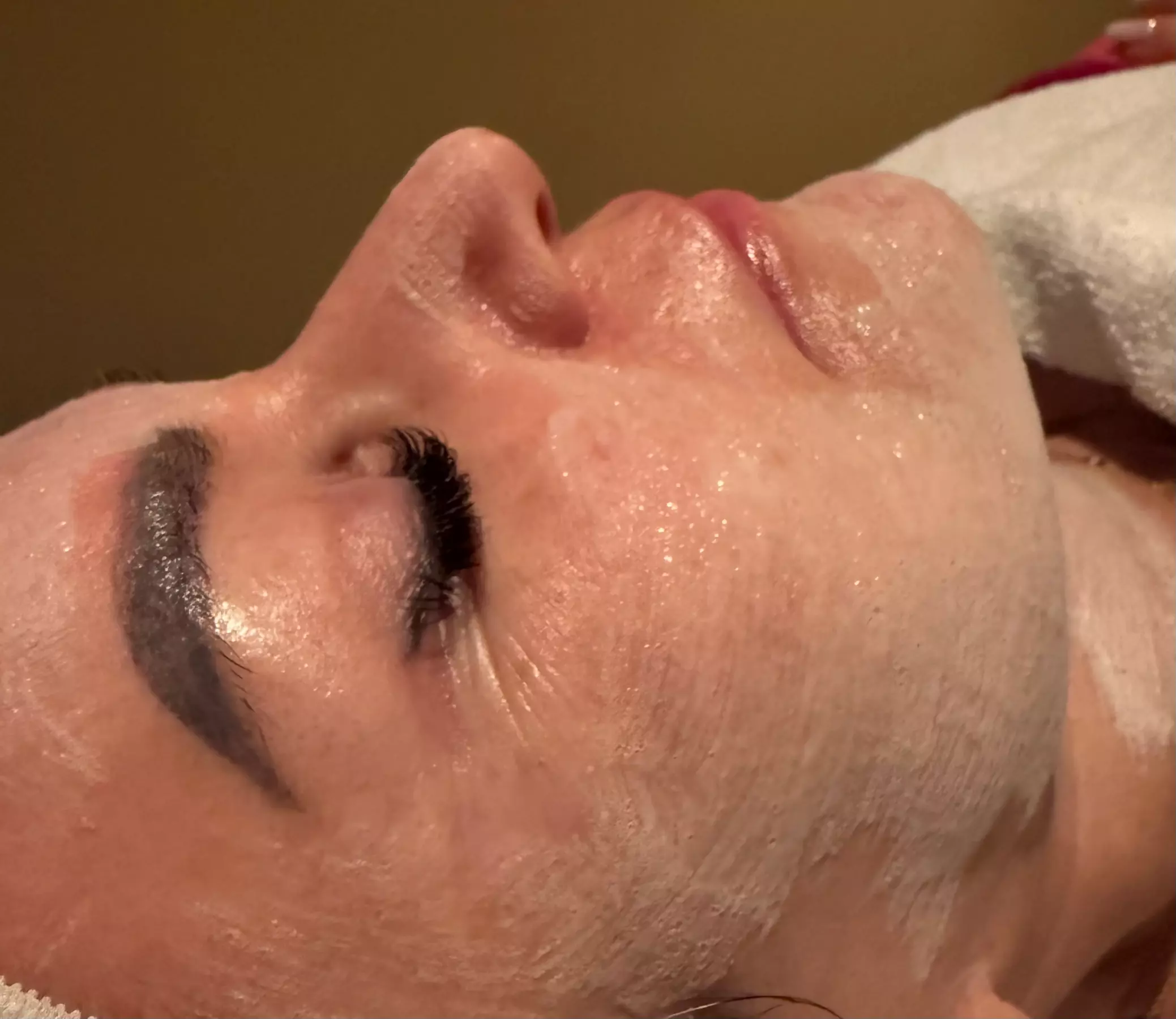 Get the Youthful Glow with Specialized Anti Aging Skin Treatment