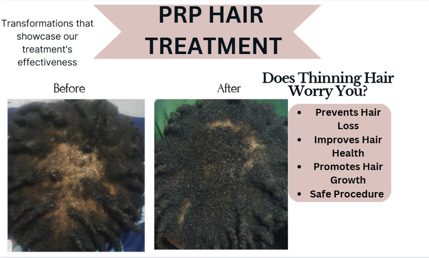 Image 1: Up to 34% Off on Ethnic Hair Service - Natural at Clinic of Aesthetics