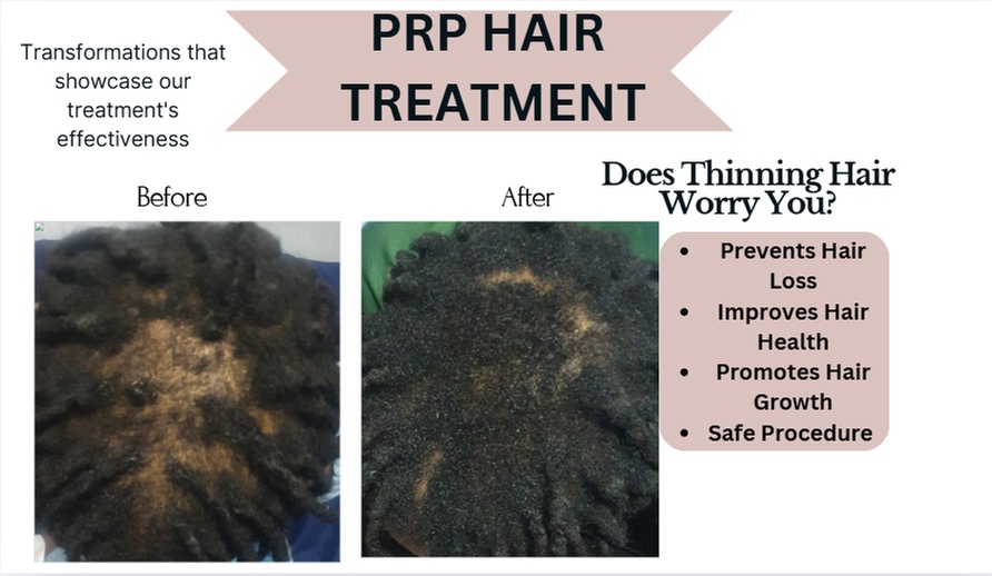 Up to 34% Off on Ethnic Hair Service - Natural at Clinic of Aesthetics