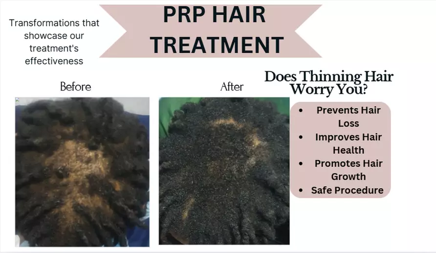 Up to 34% Off on Ethnic Hair Service - Natural at Clinic of Aesthetics - Primary Image