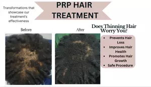 Up to 34% Off on Ethnic Hair Service - Natural at Clinic of Aesthetics