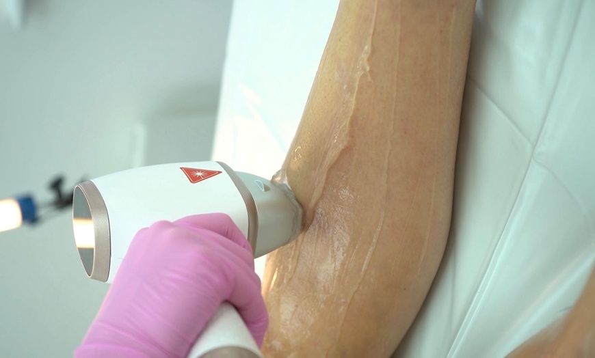 Image 9: Up to 80% Off on Laser Hair Removal at HL Lasers