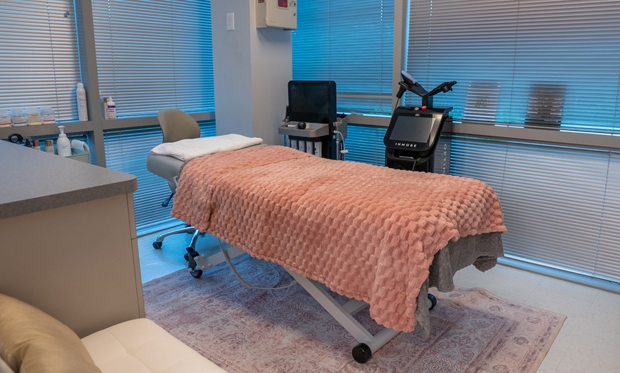 Image 2: Get Radiant Skin with 1, 2, or 3 IPL Sessions - 10 Minutes Per Session