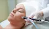 Relax with One 60, 90, or 120-Minute Micro-Needling Treatment at Total Therapy Massage & Spa (Up to 70% Off)
