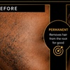 Image 3: Up to 30% Off on Electrolysis at La Belle Studio by Soraya