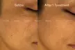 Up to 77% Off on Pampering Package at SkinVital Studio - Second Medium