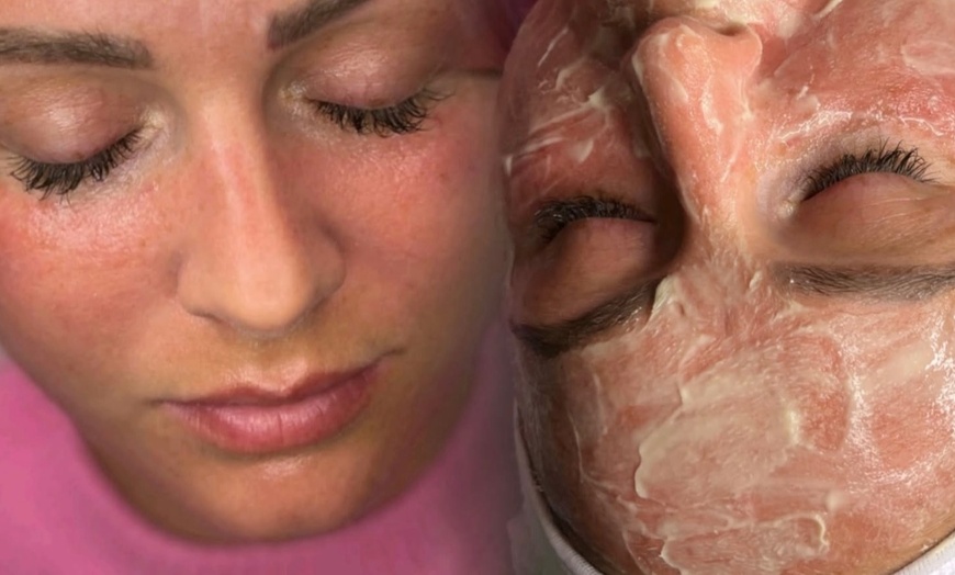 Image 3: Microneedling oder BB Glow inkl. Abreinigung für 1 Person